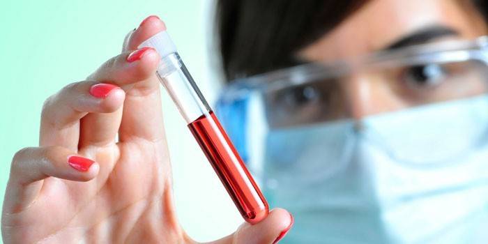 medik-derzhit-v-ruke-probirku-s-analizom-krovi.jpg