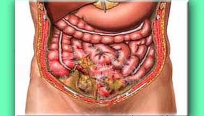 Проявление перитонита