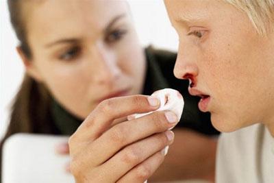 Кровотечение из носа