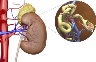 Почечная недостаточность