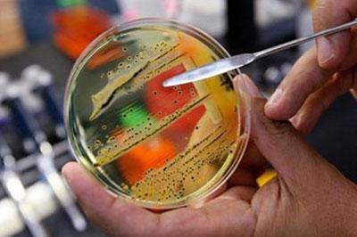 Посев на сальмонеллез