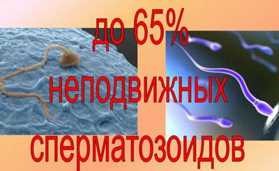 Сперматозоиды при алкоголизме