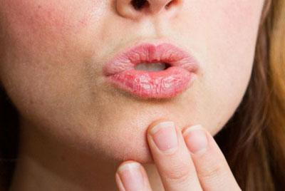 Сухие губы