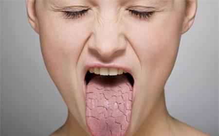 Сухость во рту