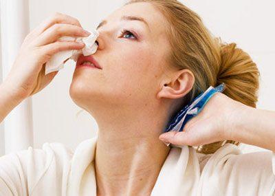 Носовое кровотечение