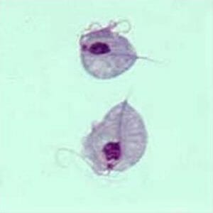 trihomonada-1.jpg