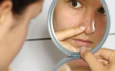 Угри на лице