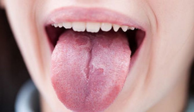vospalenie-yazyka-pri-glistah.jpg