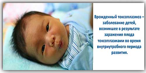 vrozhdennyj-toksoplazmoz.jpg