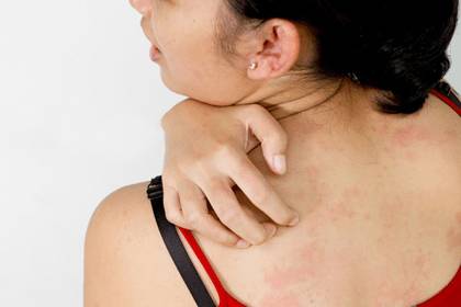 Зуд на коже