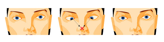 коррекция с помощью гимнастики