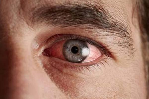 деабетическая ретинопатия вид