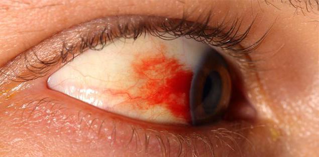 глаз при отслойке