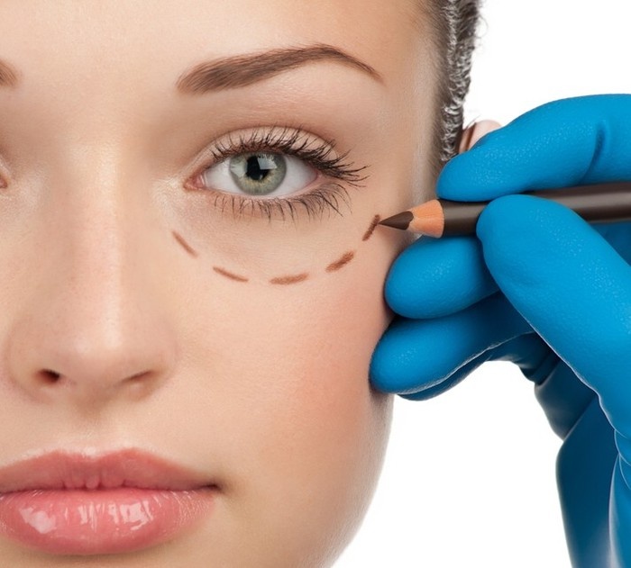 симптомы отеков под глазами