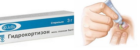 мази в глаза