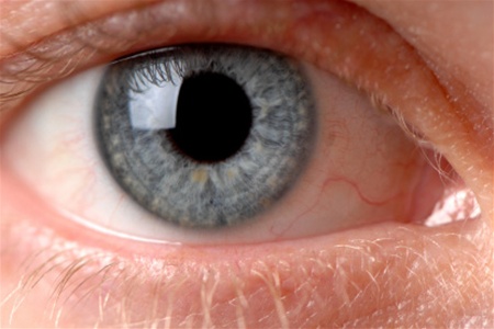 заболевания глаз