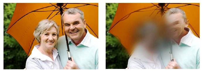 симптомы макулодистрофии