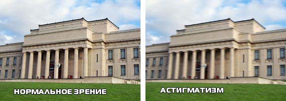 астигматизм и зрение