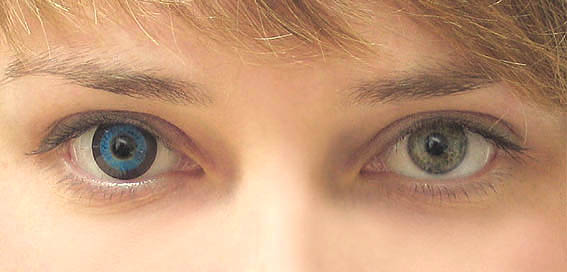 вред от линз