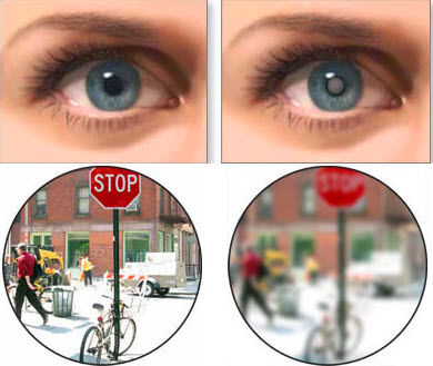 сравнение зрения