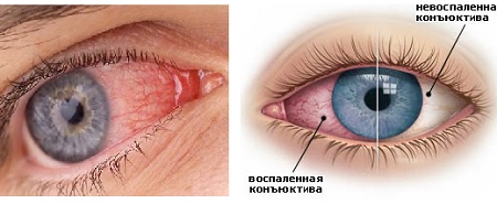 вид болезни