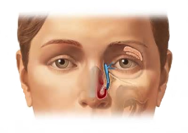 Причины заболевания