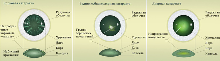 типы патологии