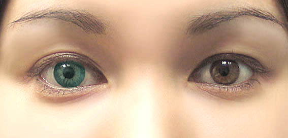 особенности контактных линз