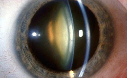 ядерный тип