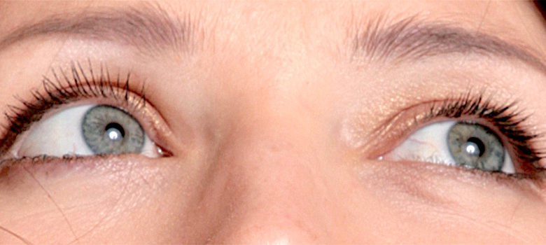 причины бельма на глазу