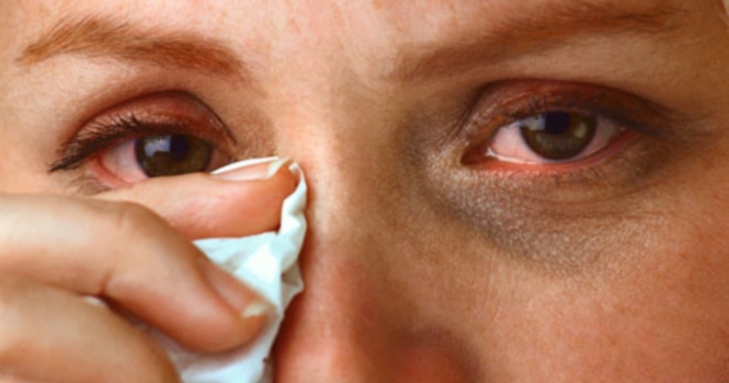 дакриоцистит лечение