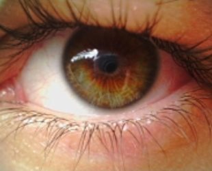 глаза при куриной слепоте