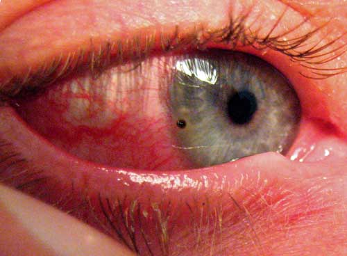 обследование