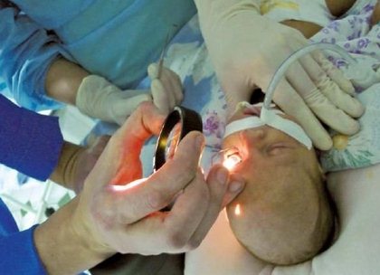 ретинопатия у новорожденных детей