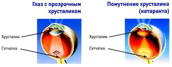 симптом патологии