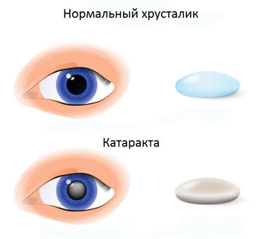 вид болезней