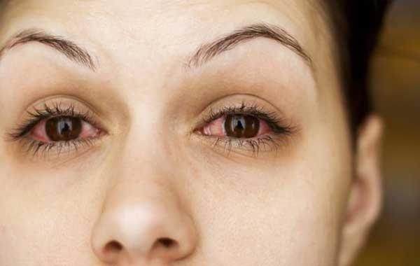 два красных глаза