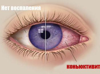 вид болезни