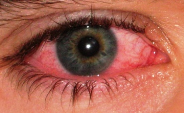 капли от красных глаз