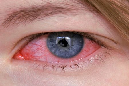 очень красные