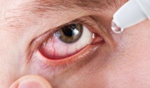 лечение красных глаз каплями