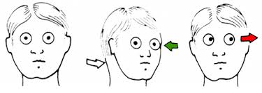 симптомы нистагма