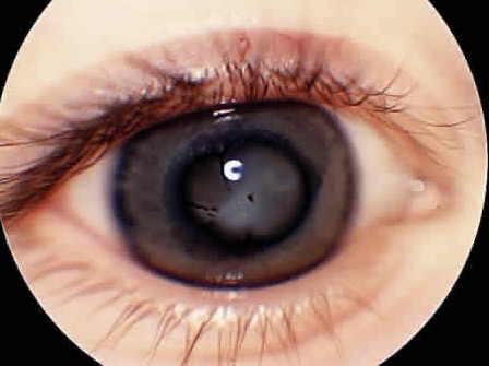 внешний вид сетчатки