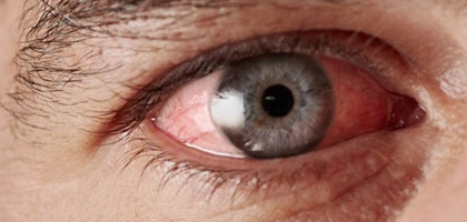 диагностика глаза